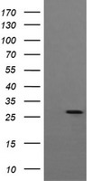 HEK293T cells were transfected with the pCMV6-ENTRY control (Left lane) or pCMV6-ENTRY KLK8 (Right lane) cDNA for 48 hrs and lysed