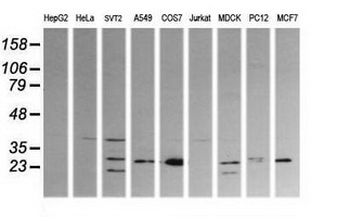 Western blot analysis of extracts (35ug) from 9 different cell lines by using anti-KLK8 monoclonal antibody (HepG2: human; HeLa: human; SVT2: mouse; A549: human; COS7: monkey; Jurkat: human; MDCK: canine; PC12: rat; MCF7: human)