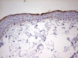 Immunohistochemical staining of paraffin-embedded Human skin tissue using anti-KLK8 mouse monoclonal antibody