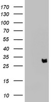 HEK293T cells were transfected with the pCMV6-ENTRY control (Left lane) or pCMV6-ENTRY KLK8 (Right lane) cDNA for 48 hrs and lysed