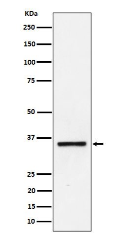 Western blot analysis of Kallikrein 8 expression in Jurkat cell lysate