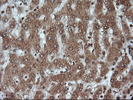 m03901 anti kallikrein 8 klk8 mouse monoclonal antibody clone id oti16g2 ihc testing 5