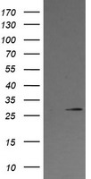 HEK293T cells were transfected with the pCMV6-ENTRY control (Left lane) or pCMV6-ENTRY KLK8 (Right lane) cDNA for 48 hrs and lysed