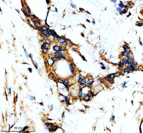 IHC analysis of YWHAQ using anti-YWHAQ antibody (M03904)