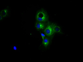m03911 2 anti pka r2 prkar2a mouse monoclonal antibody clone id oti1a7 if testing 10