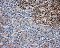 Immunohistochemical staining of paraffin-embedded pancreas tissue within the normal limits using anti-PRKAR2A mouse monoclonal antibody