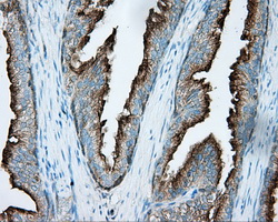 m03911 2 anti pka r2 prkar2a mouse monoclonal antibody clone id oti1a7 ihc testing 5