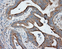 m03911 2 anti pka r2 prkar2a mouse monoclonal antibody clone id oti1a7 ihc testing 6