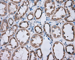 m03911 2 anti pka r2 prkar2a mouse monoclonal antibody clone id oti1a7 ihc testing 7