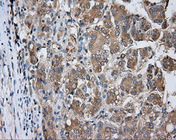 m03911 2 anti pka r2 prkar2a mouse monoclonal antibody clone id oti1a7 ihc testing 8