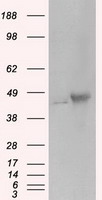 HEK293T cells were transfected with the pCMV6-ENTRY control (Left lane) or pCMV6-ENTRY PRKAR2A (Right lane) cDNA for 48 hrs and lysed