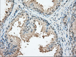 m03911 3 anti pka r2 prkar2a mouse monoclonal antibody clone id oti5f1 ihc testing 4