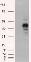 m03911 3 anti pka r2 prkar2a mouse monoclonal antibody clone id oti5f1 wb testing 1