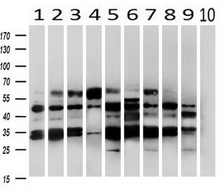m03911 3 anti pka r2 prkar2a mouse monoclonal antibody clone id oti5f1 wb testing 2