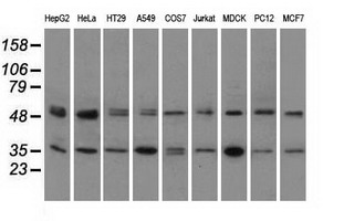 m03911 3 anti pka r2 prkar2a mouse monoclonal antibody clone id oti5f1 wb testing 3