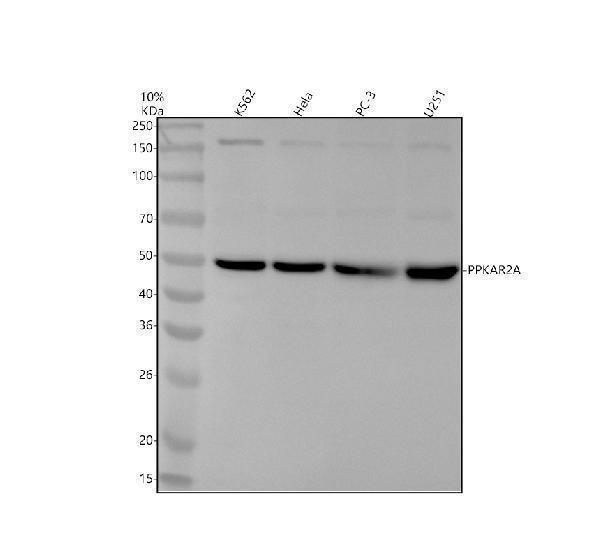 Western blot analysis of PPKAR2A using anti-PPKAR2A antibody (M03911-4)