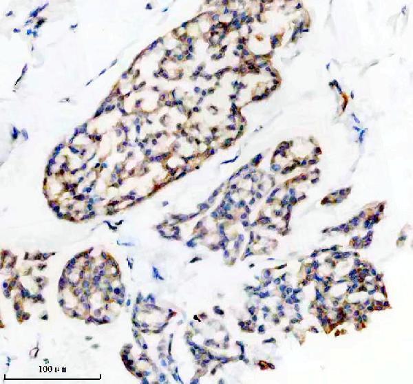 IHC analysis of PRKAR2A using anti-PRKAR2A antibody (M03911-4)