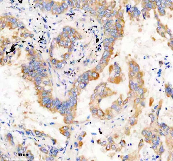 IHC analysis of PRKAR2A using anti-PRKAR2A antibody (M03911-4)