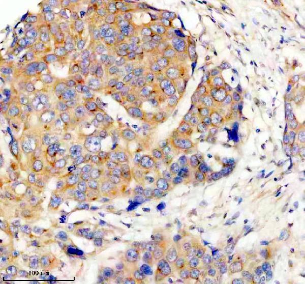 m03911 4 prkar2a primary antibodies ihc testing 3