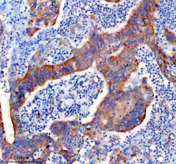 m03911 4 prkar2a primary antibodies ihc testing 4