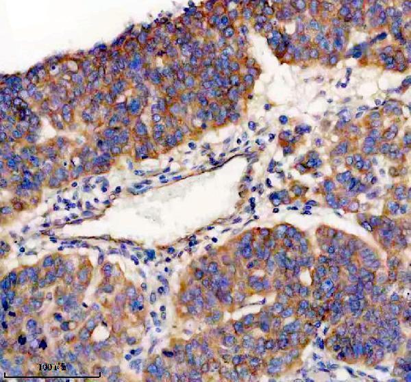 m03911 4 prkar2a primary antibodies ihc testing 5