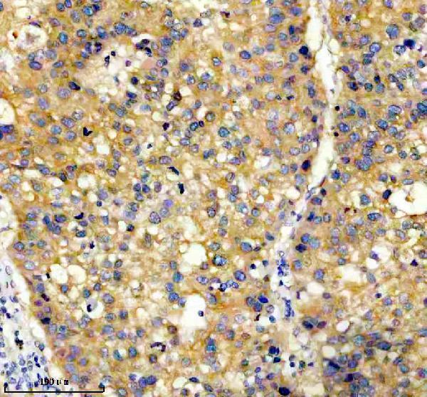 m03911 4 prkar2a primary antibodies ihc testing 6