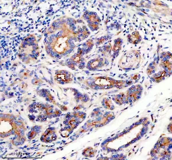 m03911 4 prkar2a primary antibodies ihc testing 7