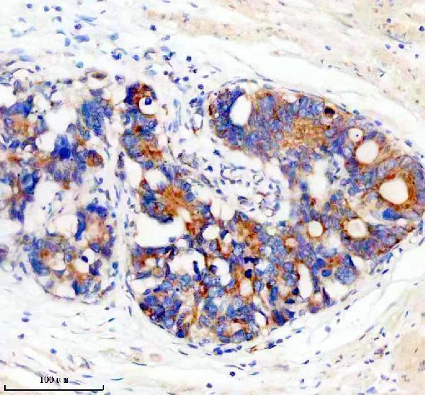 m03911 4 prkar2a primary antibodies ihc testing 8