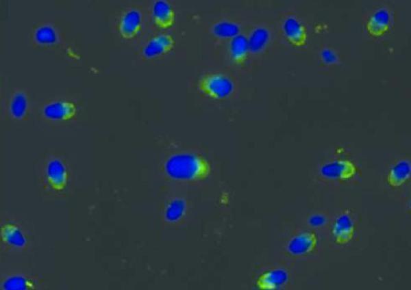 Immunocytochemistry staining of normal human sperma with anti-PRKAR2A antibody (intracellular signal in acrosomes, green); DNA visualized by DAPI (blue)