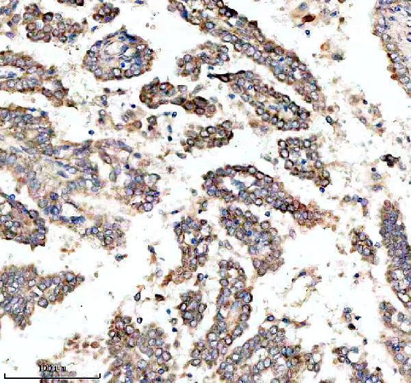  IHC analysis of MYO7A using anti-MYO7A antibody (M03915)