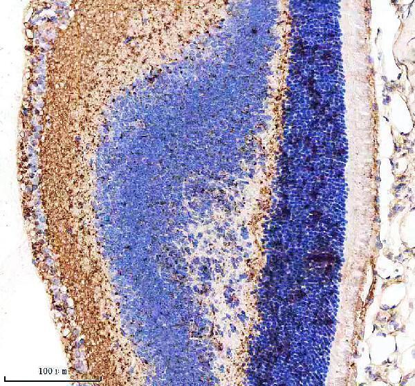  IHC analysis of MYO7A using anti-MYO7A antibody (M03915)