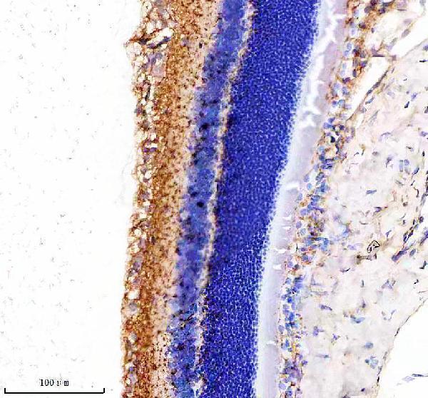 m03915 myo7a primary antibodies ihc testing 4