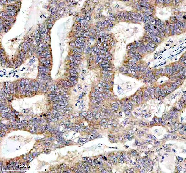 m03915 myo7a primary antibodies ihc testing 5