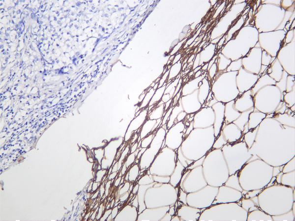 Human adipose was stained with anti-Perilipin-1 rabbit antibody