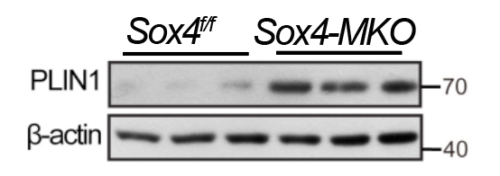 Western blot analysis of PLIN1 using anti-PLIN1 antibody (M03918)