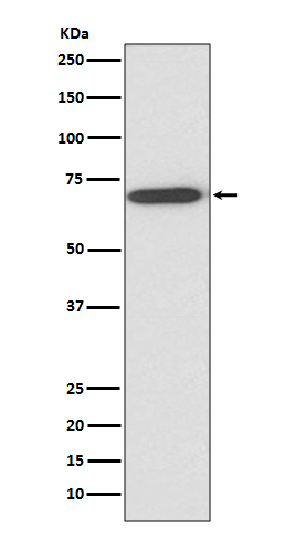 Western blot analysis of Perilipin A expression in human fetal liver lysate