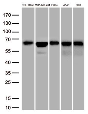 m03920 ifit3 primary antibodies wb testing 2