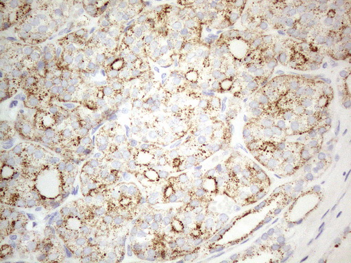 m03921 1 anti znf217 mouse monoclonal antibody clone id oti2b4 ihc testing 2