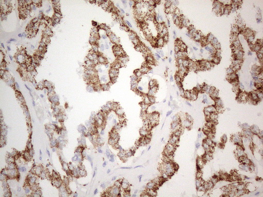 m03921 1 anti znf217 mouse monoclonal antibody clone id oti2b4 ihc testing 3