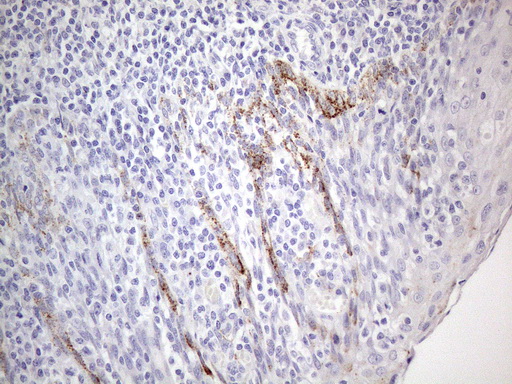 m03921 1 anti znf217 mouse monoclonal antibody clone id oti2b4 ihc testing 4
