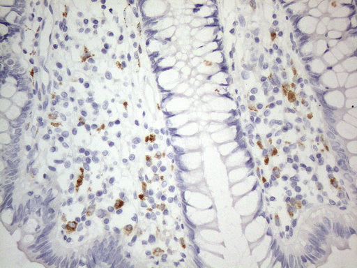 m03921 1 anti znf217 mouse monoclonal antibody clone id oti2b4 ihc testing 5