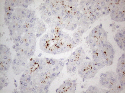 m03921 1 anti znf217 mouse monoclonal antibody clone id oti2b4 ihc testing 6