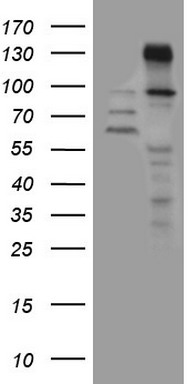 m03921 1 anti znf217 mouse monoclonal antibody clone id oti2b4 wb testing 1