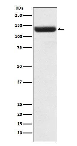 Western blot analysis of ZNF217 expression in Caco2 cell lysate.