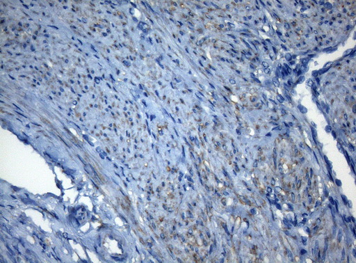 Immunohistochemical staining of paraffin-embedded Human endometrium tissue within the normal limits using anti-ZNF217 mouse monoclonal antibody