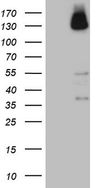 HEK293T cells were transfected with the pCMV6-ENTRY control (Left lane) or pCMV6-ENTRY ZNF217 (Right lane) cDNA for 48 hrs and lysed