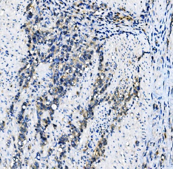  IHC analysis of EIF4A1 using anti-EIF4A1 antibody (M03922-1)