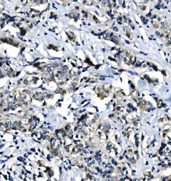  IHC analysis of EIF4A1 using anti-EIF4A1 antibody (M03922-1)