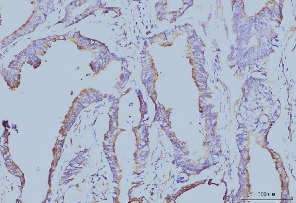 m03922 2 eif4a primary antibodies ihc testing 3