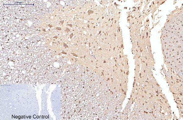 m03922 eif4a1 primary antibodyes ihc testing 10